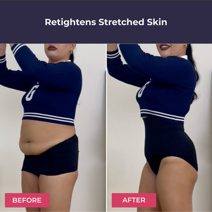 LACULOTTE™ ||| Tummy Control & 3D massage Panty (up)